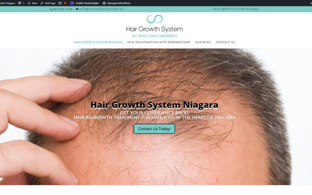 Hair Growth System Niagara