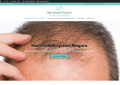 Hair Growth System Niagara